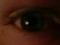 MyEye